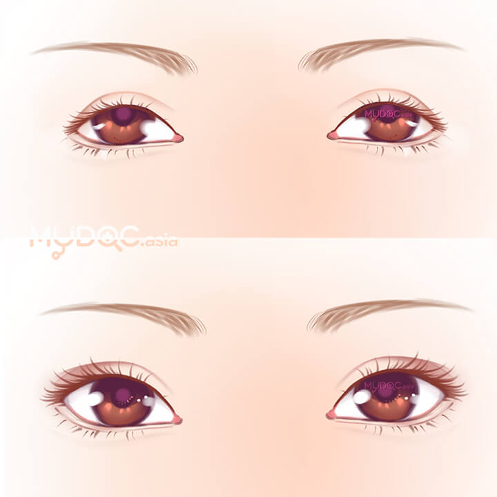 Pakar Mata Terbaik: Eye Specialist di Balik Pulau, Malaysia untuk Rawatan Berkualiti