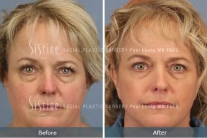 Leong Eye Clinic & Surgery 4 Leong Eye Clinic & Surgery