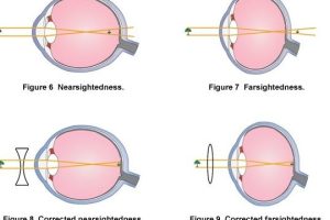 On Eyes Optics 6 On Eyes Optics