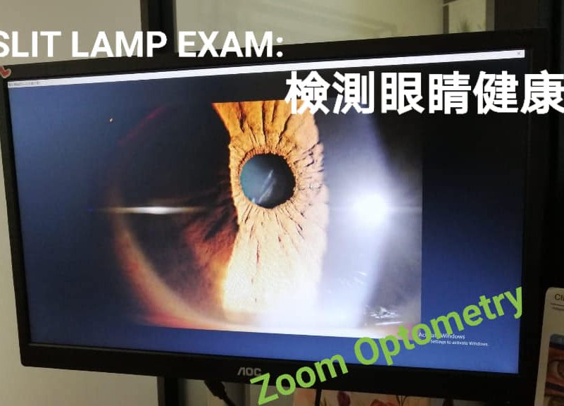 zoom optometry e88892e8a786e79cbce7a791e8a786e58589e5ada6